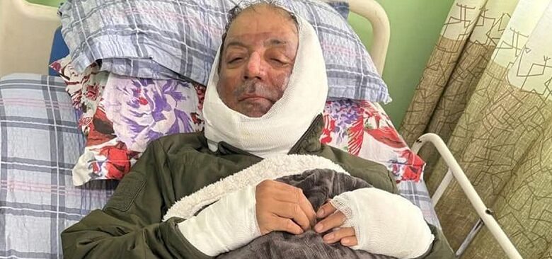 बेलुन पड्किँदा घाइते पोखरा महानगरका मेयर धनराज आचार्य डिस्चार्ज